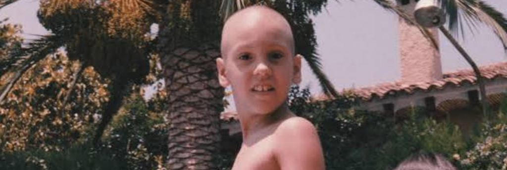 Mireia Cabañes pierna: te cuento qué me paso. Fotografía de Mireia sin pelo en pleno proceso de cancer infantil