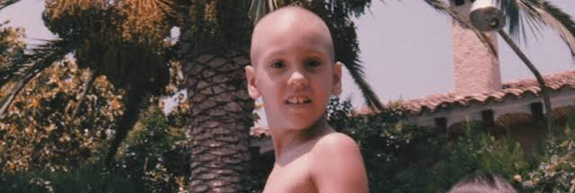 Mireia Cabañes pierna: te cuento qué me paso. Fotografía de Mireia sin pelo en pleno proceso de cancer infantil